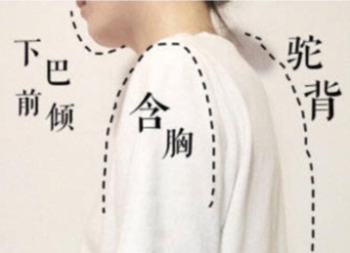 南寧美容學(xué)校：堅(jiān)持一個(gè)月，駝背變直背