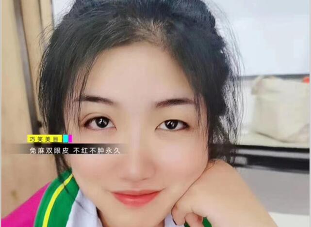 麗竹學(xué)?！凹y繡+雙眼皮”課程開講