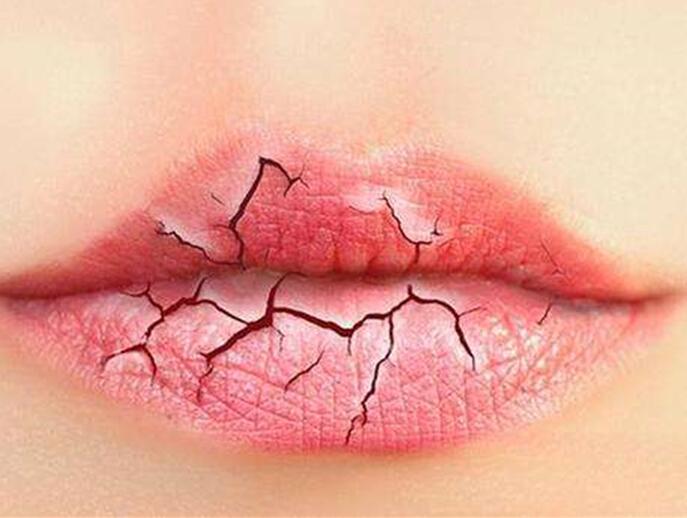 6個(gè)美容技巧，解決秋季嘴唇干燥