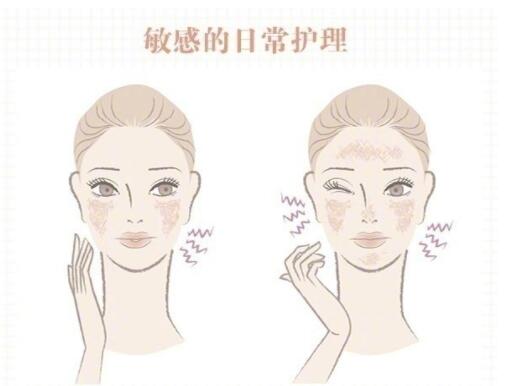 敏感肌保養(yǎng)大全！
