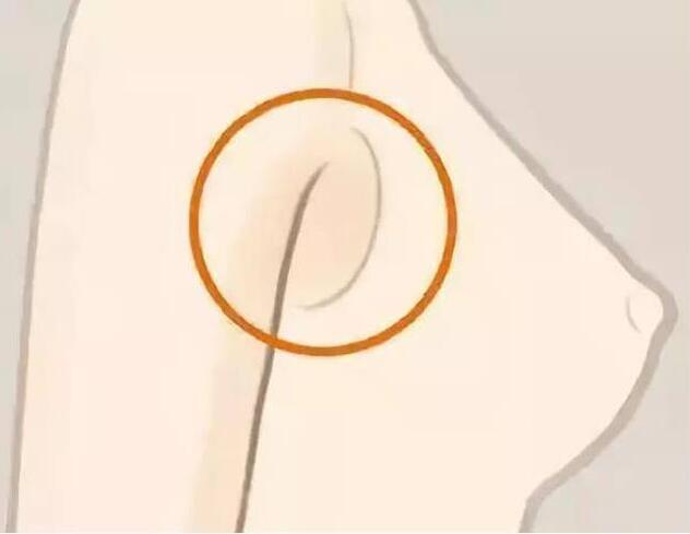 減副乳，瘦手臂一招就解決！