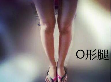 糾正你的腿型！