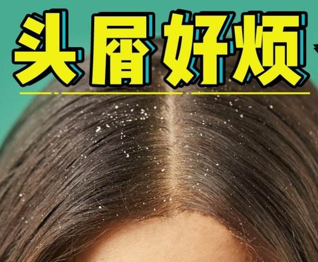 南寧正規(guī)美發(fā)培訓(xùn)學(xué)校分享：冬天如何減少頭屑過(guò)多？