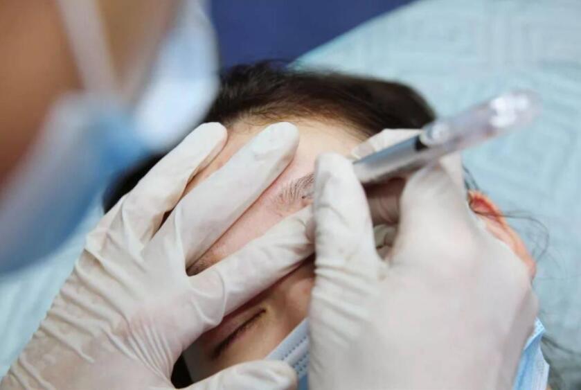 紋繡遇到容易出血的皮膚怎么辦？南寧專業(yè)紋繡培訓(xùn)教你