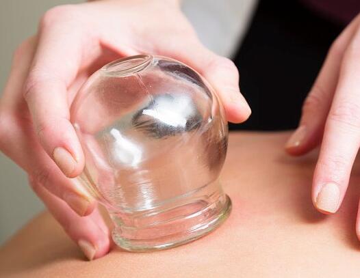 4種不同的拔罐方法，廣西美容學(xué)校整理好了