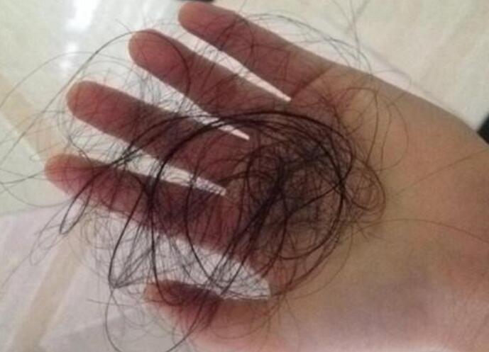 脫發(fā)女孩必備寶典！南寧美發(fā)學(xué)校教你