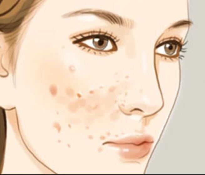 廣西美容師培訓(xùn)正規(guī)學(xué)校：專治色斑的寶藏水果