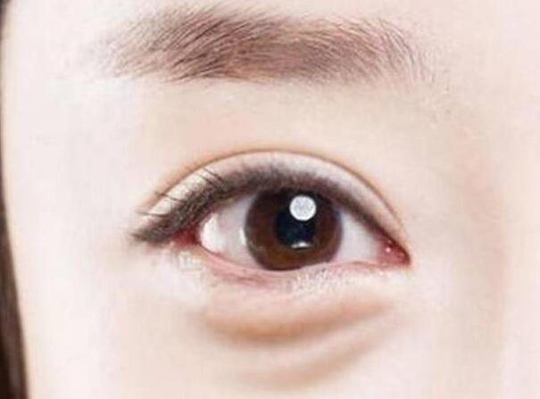 眼袋？淚溝？臥蠶？南寧美容學(xué)校教你辨別