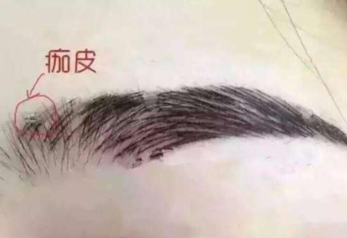 紋眉結(jié)痂時(shí)要注意什么？麗紋竹繡學(xué)校教你