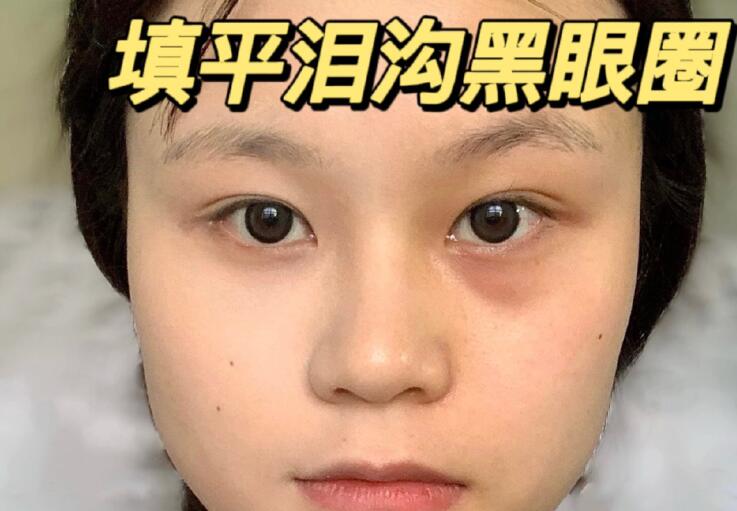 填平淚溝黑眼圈教程，廣西南寧化妝學(xué)校分享