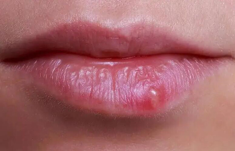 紋唇后起泡怎么辦？南寧紋唇培訓(xùn)學(xué)校教你方法