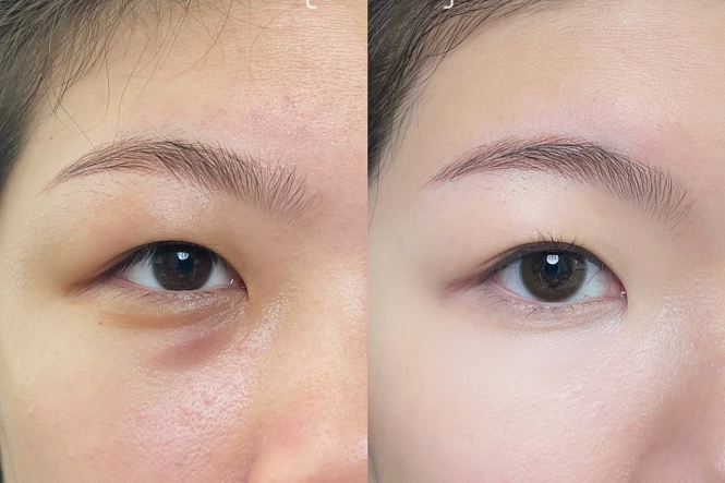 新手遮瑕教程，南寧化妝課程基礎(chǔ)分享