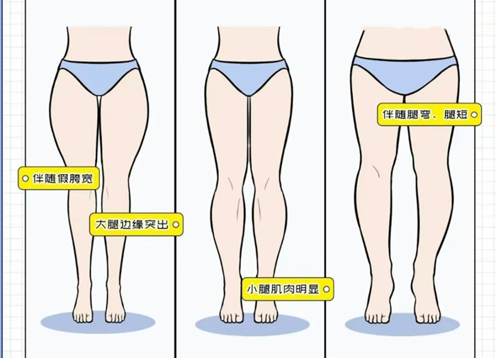 腿粗女生穿搭攻略，廣西彩妝造型搭配