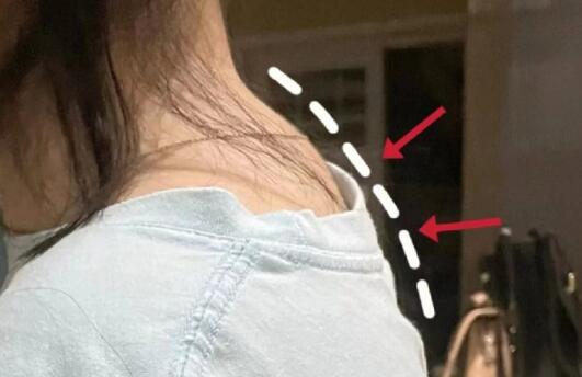 廣西美容養(yǎng)生培訓(xùn)---頸椎管理技巧