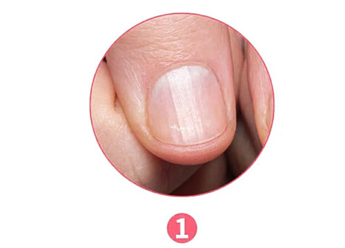 女生氣血不足六大表現(xiàn)，南寧美容養(yǎng)生資訊報道