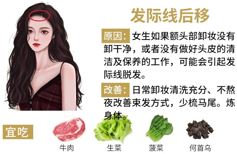 如何改善掉頭發(fā)？南寧頭療養(yǎng)發(fā)護發(fā)教學(xué)