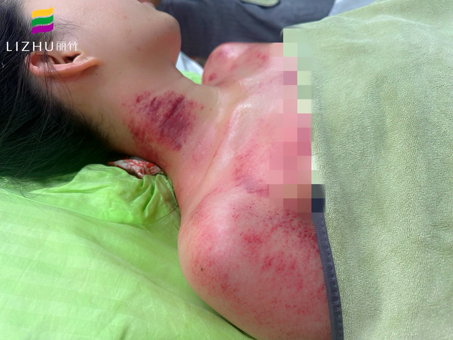 廣西學(xué)刮痧培訓(xùn)班 | 廣西學(xué)刮痧學(xué)費(fèi)多少？