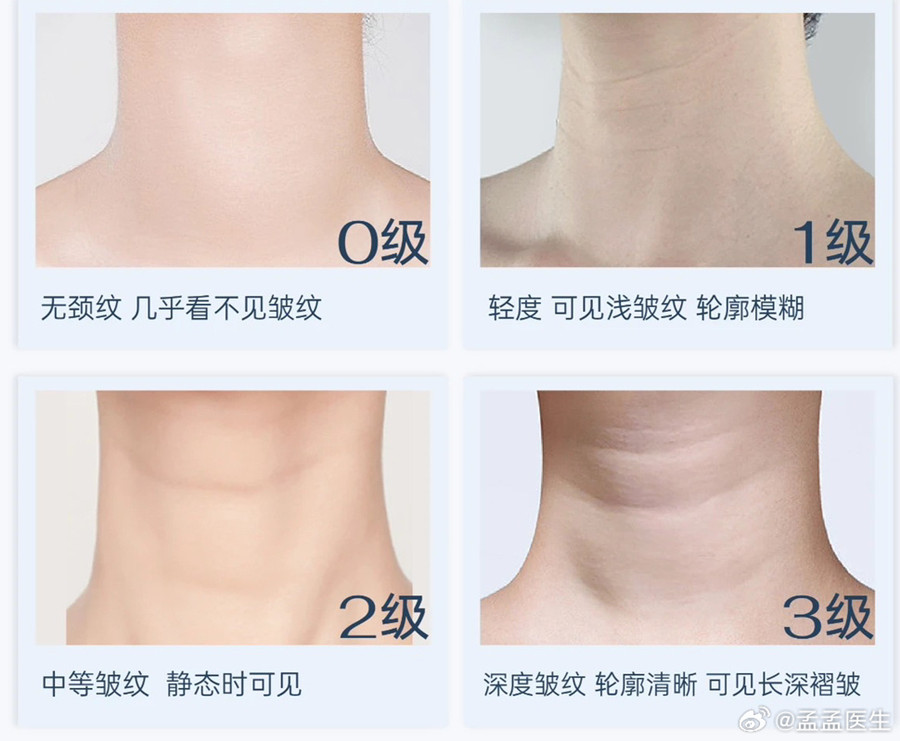 如何緩解頸紋？南寧美體美容管理培訓(xùn)