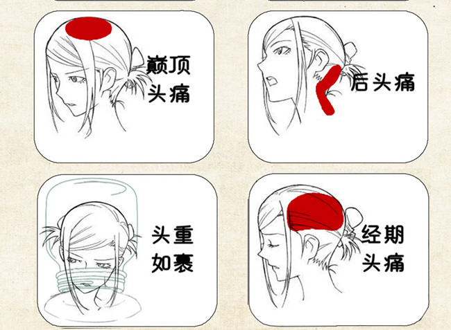 不同頭痛類型經(jīng)絡(luò)護(hù)理方法，廣西中醫(yī)美容培訓(xùn)