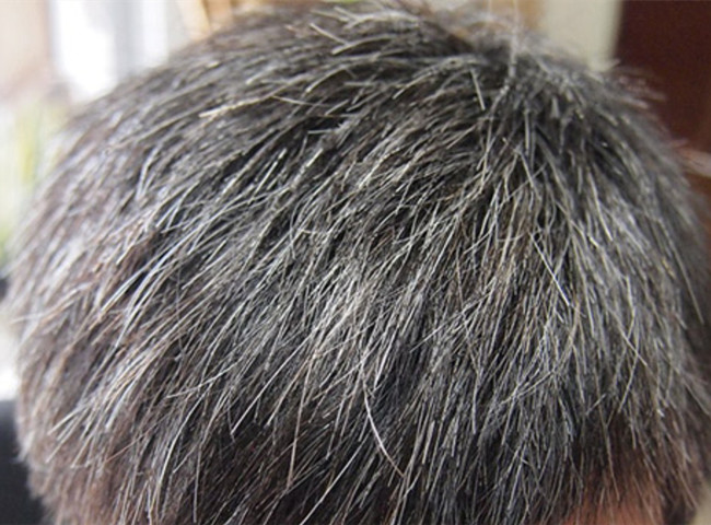 南寧美發(fā)基礎(chǔ)教學(xué)：為什么會(huì)長(zhǎng)白頭發(fā)？