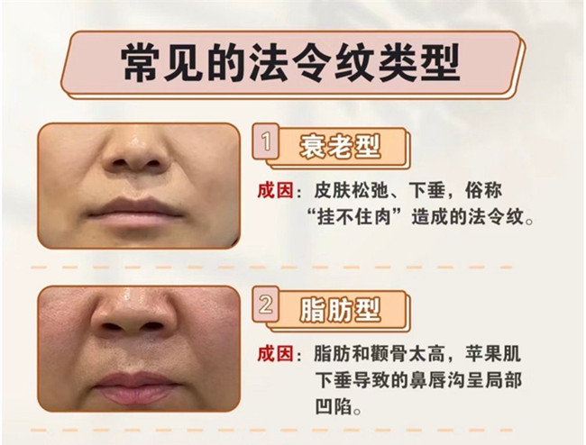 你的法令紋路是怎么產(chǎn)生的 | 美容護(hù)膚小知識